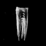 Chalk Teeth cover art